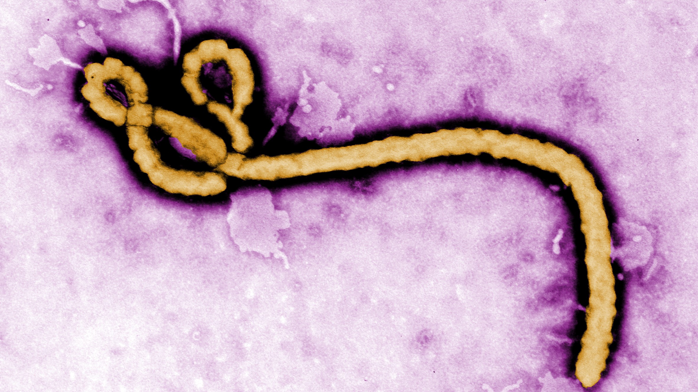This colorized transmission electron micrograph (TEM) revealed some of the ultrastructural morphology displayed by an Ebola virus virion. See PHIL 1181 for a black and white version of this image.